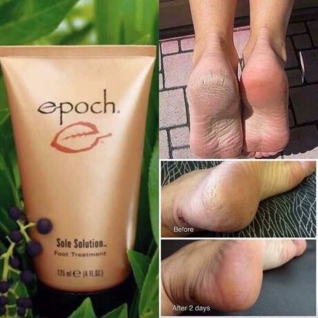 Tratament pentru picioare Epoch Sole Solution 2